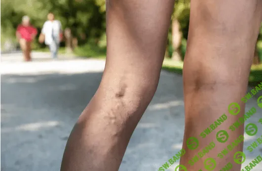 7 привычек, которые подрывают здоровье больше, чем курение