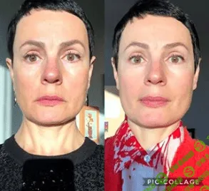 [Анна Ахметшина] Красота и омоложение (2019)