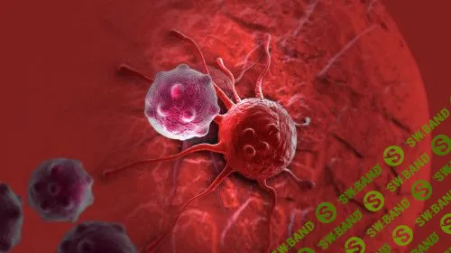 [Архэ] Рак с “высоты птичьего полета” (2023)