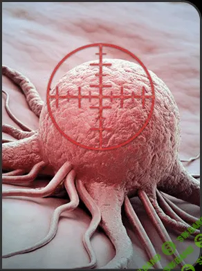 [AST Production] Онкология. Излечение от рака