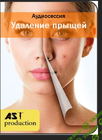 [Ast Production] Удаление прыщей (2017)