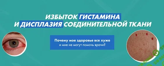 [Дарья Ермишина] Избыток гистамина и дисплазия соединительной ткани (2025)