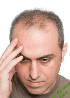 [eko-zdrav] STOP выпадение! — Возвращаем волосы, выращиваем их на лысине, увеличиваем густоту