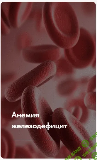 [Елена Ержанова] Лечебный протокол «Анемия железодефицит» (2023)
