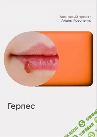 Герпес [Алёна Ковальчук]