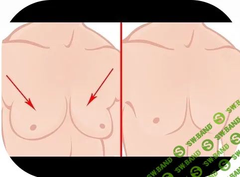 Гинекомастия в разные периоды жизни мужчины - современные подходы к диагностике и коррекции [Pro et Contra] [Юлия Тишова]