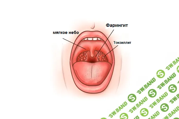 [Игорь Атрощенко] Диагностика и лечение тонзиллитов, ларингитов и фарингитов (2020)