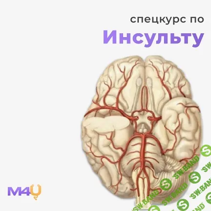 [Medforyou - школа медицины] Спецкурс по инсульту (2025)