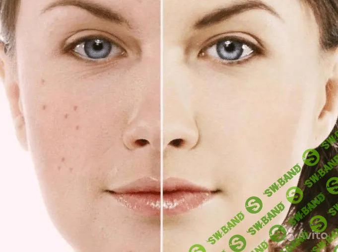 [Наталия Ткаченко] Жирная кожа (2019)