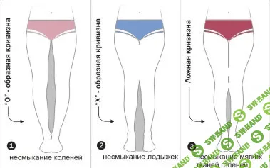[Вадим Усачев] Как за 2 месяца исправить кривизну ног